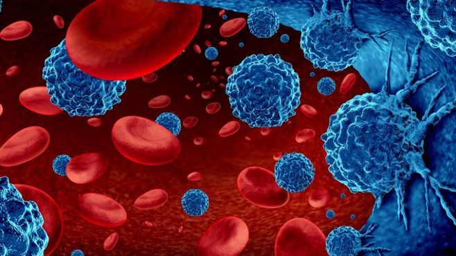 Fleury + BP + Bradesco pioram cenário para Oncoclínicas