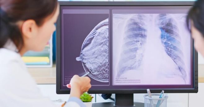 Oncoclínicas faz acordo de R$ 280 mi com Unimed Recife