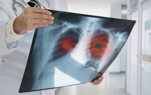 Oncoclínicas tem lucro recorde com reestruturação societária