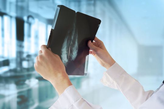RESEARCH: BTG inicia Oncoclínicas com ‘buy’; Santander eleva XP; os ‘bulls’ e ‘bears’ da Intelbrás