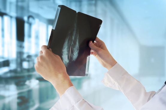 RESEARCH: BTG inicia Oncoclínicas com ‘buy’; Santander eleva XP; os ‘bulls’ e ‘bears’ da Intelbrás