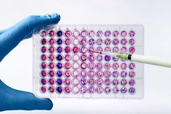 O plano da BIOMM para crescer nos biomedicamentos