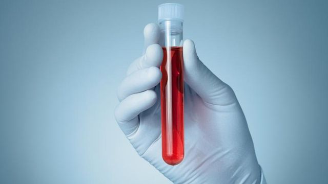 A luta de dois cientistas para detectar o câncer mais cedo